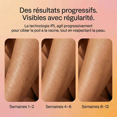 Pulsy™ - Épilateur à lumière pulsée